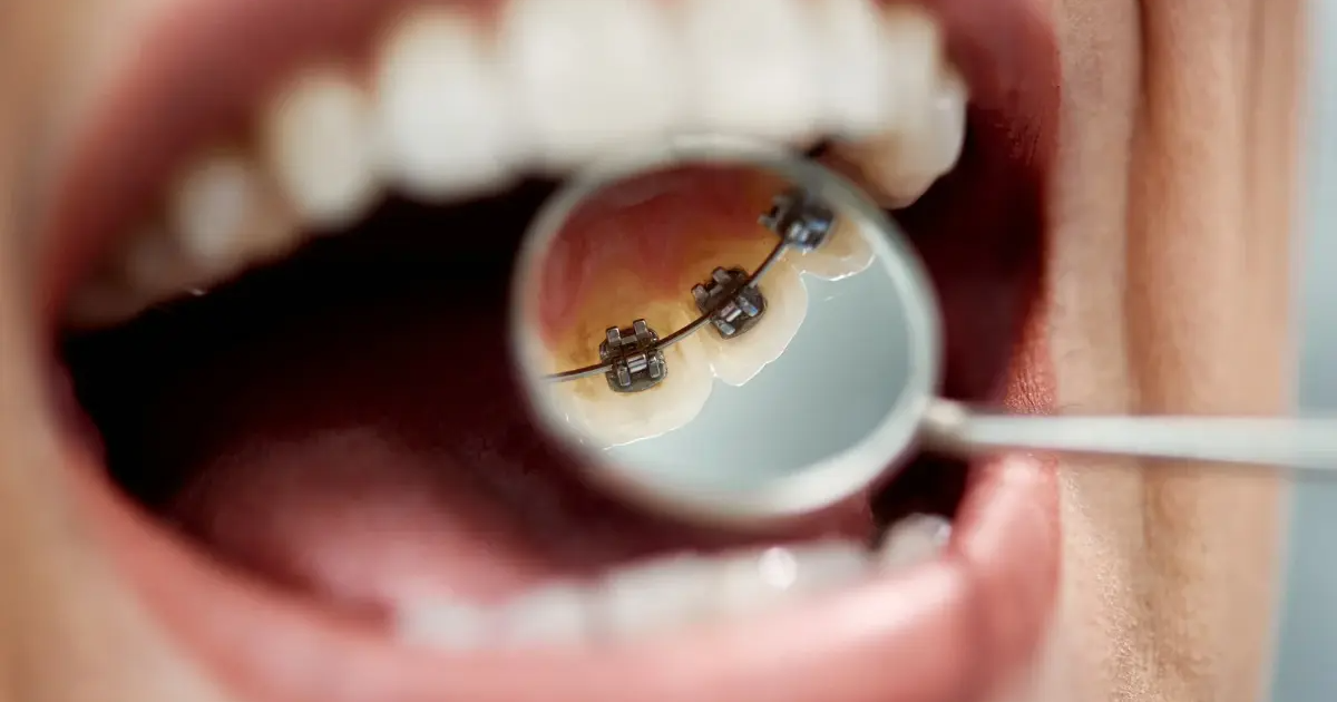 Wizyta u ortodonty – co warto wiedzieć, zanim przekroczysz próg gabinetu?